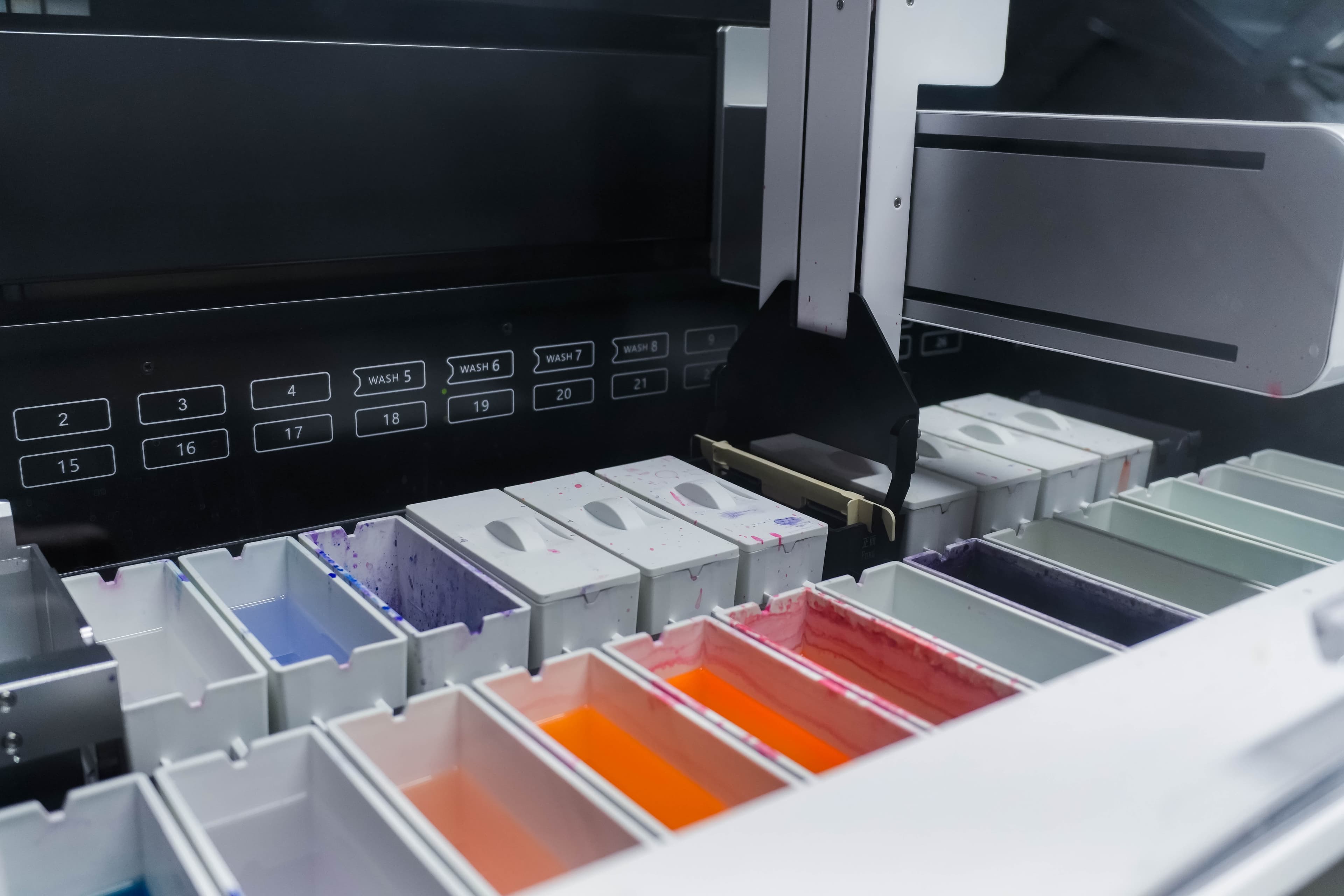 Técnica realizando coloração de lâminas no Laboratório Citomed