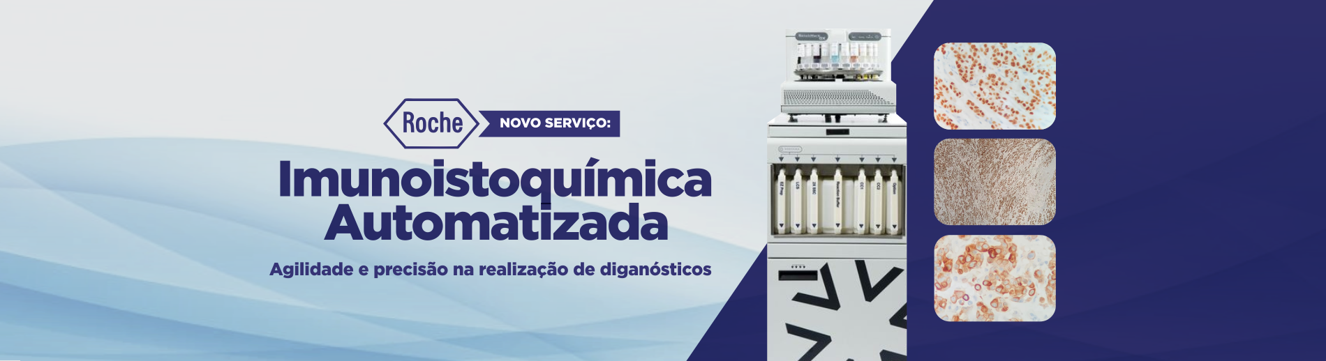 Imunoistoquímica Automatizada - Laboratório Citomed